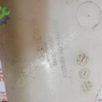 HYUNDAİ ACCENT BLUE RADYATÖR YEDEK SU BİDONU 25430-1R500