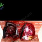 Hyundai Accent 2003-06 sağ sol stop sıfır ithal